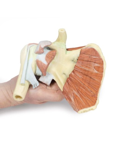 Dissezione profonda di un cingolo scapolare destro preservando una scapola