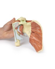 Dissezione profonda di un cingolo scapolare destro preservando una scapola