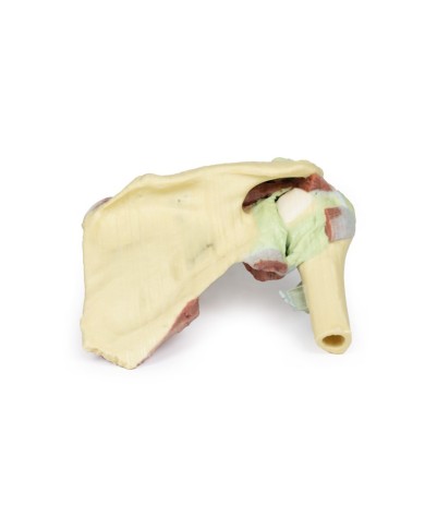 Dissezione profonda di un cingolo scapolare destro preservando una scapola