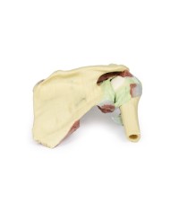 Dissezione profonda di un cingolo scapolare destro preservando una scapola