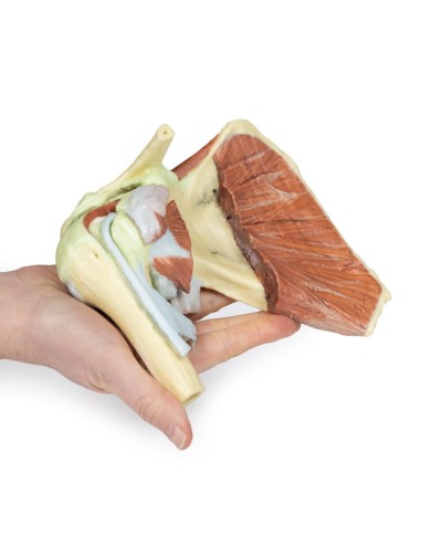 Dissezione profonda di un cingolo scapolare destro preservando una scapola