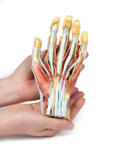 Modello anatomico di mano e polso con sindrome del tunnel carpale Modello anatomico di mano e polso con sindrome del tunnel carpale