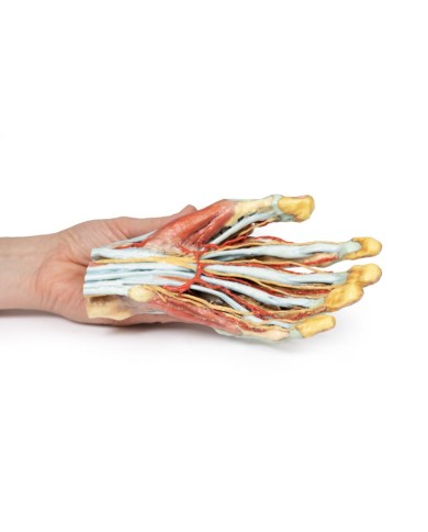 Modello anatomico di mano e polso con sindrome del tunnel carpale Modello anatomico di mano e polso con sindrome del tunnel carpale