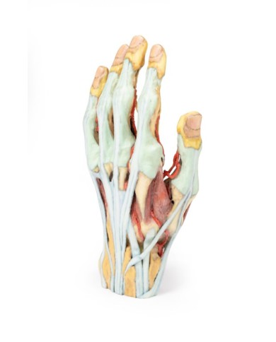 Modello anatomico di mano e polso con sindrome del tunnel carpale Modello anatomico di mano e polso con sindrome del tunnel carpale