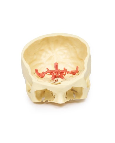 Poligono di Willis (circolo di Willis) - Erler Zimmer 3D anatomy Series