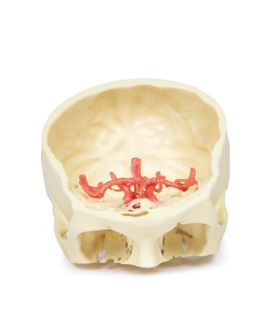 Poligono di Willis (circolo di Willis) - Erler Zimmer 3D anatomy Series