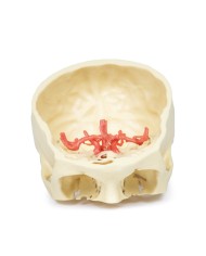 Poligono di Willis (circolo di Willis) - Erler Zimmer 3D anatomy Series