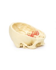 Poligono di Willis (circolo di Willis) - Erler Zimmer 3D anatomy Series