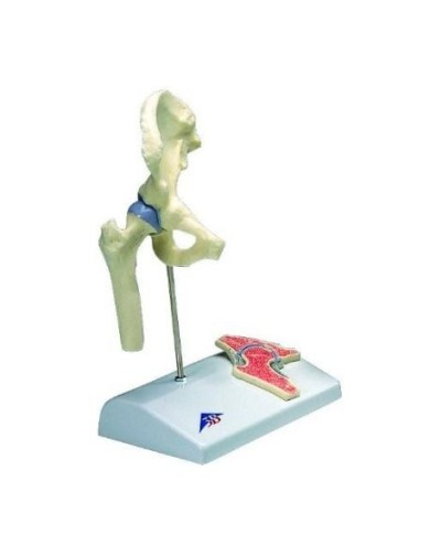 3B Scientific, modello di mini articolazione dell'anca A84/1 con sezione trasversale