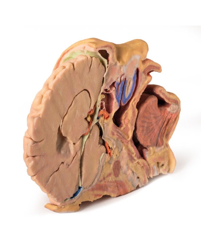 Dissezione di testa e collo Erler Zimmer 3D anatomy Series