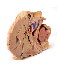 Dissezione di testa e collo Erler Zimmer 3D anatomy Series