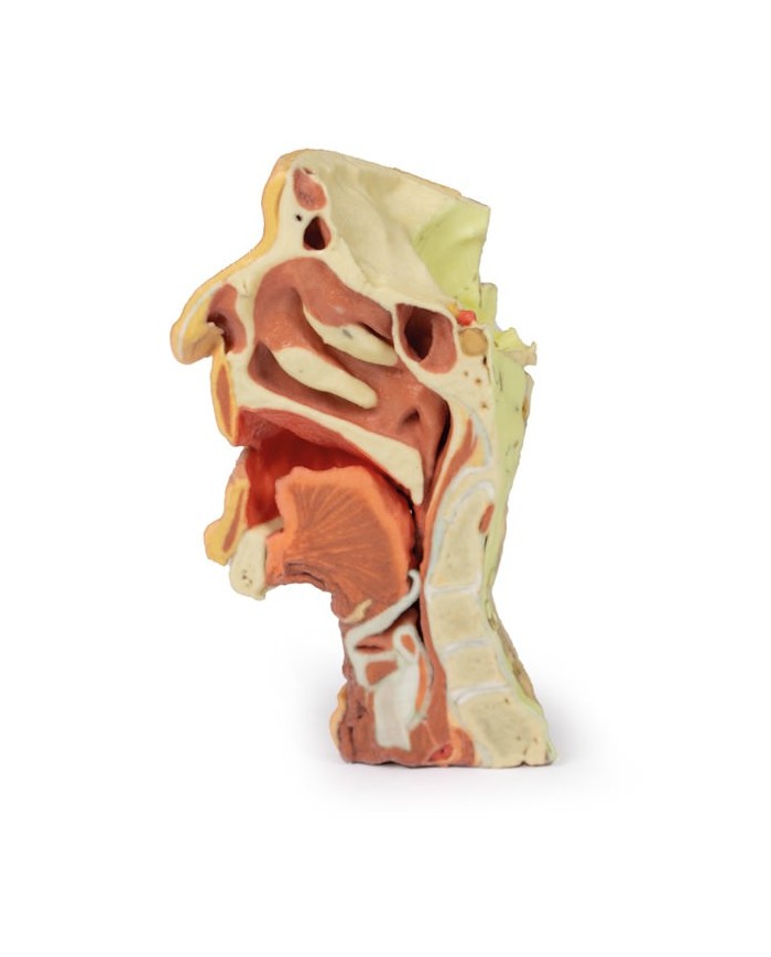 Dissezione profonda del viso, fossa infratemporale - Erler Zimmer 3D anatomy Series