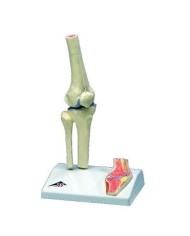 3B scientific, modello di mini articolazione del ginocchio con sezione trasversale, su base A85/1