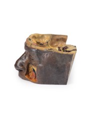 Orbita Superiore Erler Zimmer 3D anatomy Series