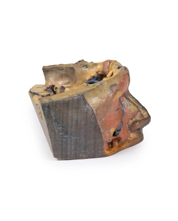 Orbita Superiore Erler Zimmer 3D anatomy Series