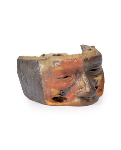 Orbita Superiore Erler Zimmer 3D anatomy Series