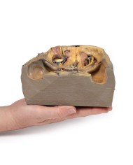 Orbita Superiore Erler Zimmer 3D anatomy Series