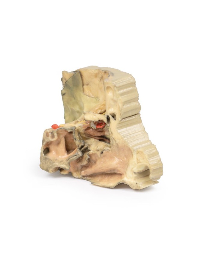 Orbita Mediale Erler Zimmer 3D anatomy Series