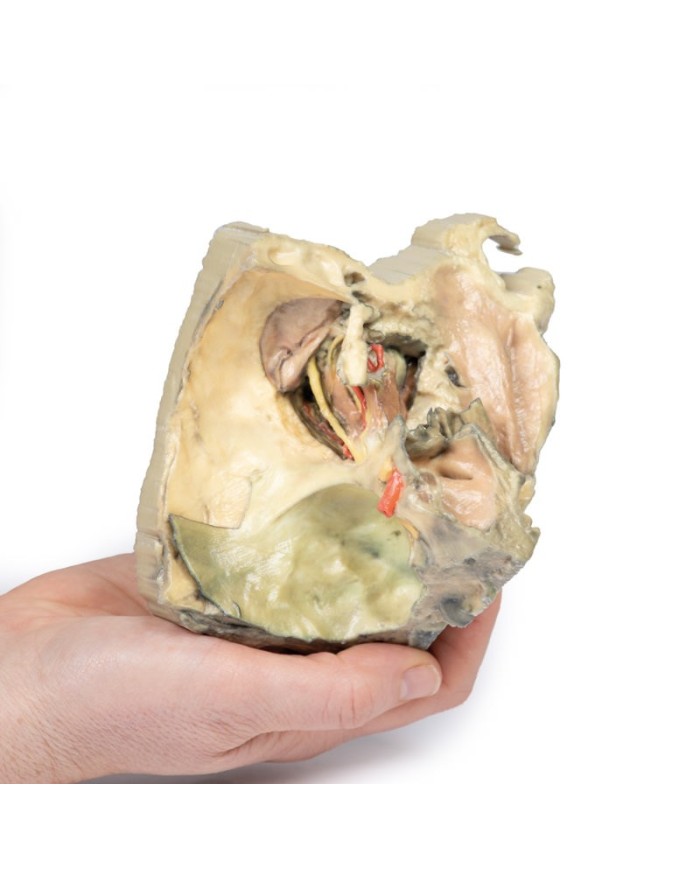 Orbita Mediale Erler Zimmer 3D anatomy Series