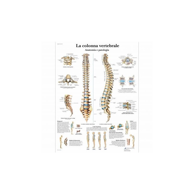 3B Scientific, tavola anatomica, La colonna vertebrale, anatomia e patologia (cod, VR4152L)