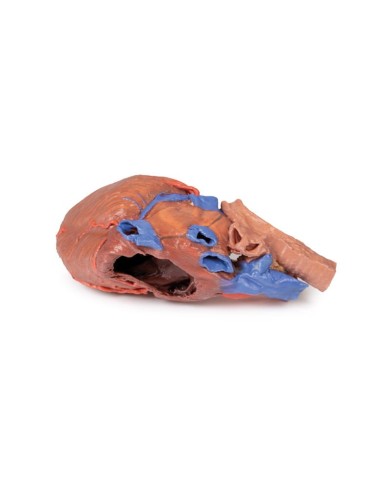 Cuore e trachea distale carena e bronchi primari Erler Zimmer 3D anatomy Cuore e trachea distale carena e bronchi primari Erler Zimmer 3D anatomy