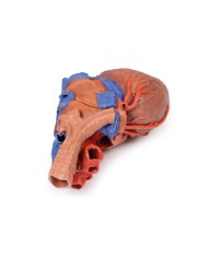 Cuore e trachea distale carena e bronchi primari Erler Zimmer 3D anatomy
