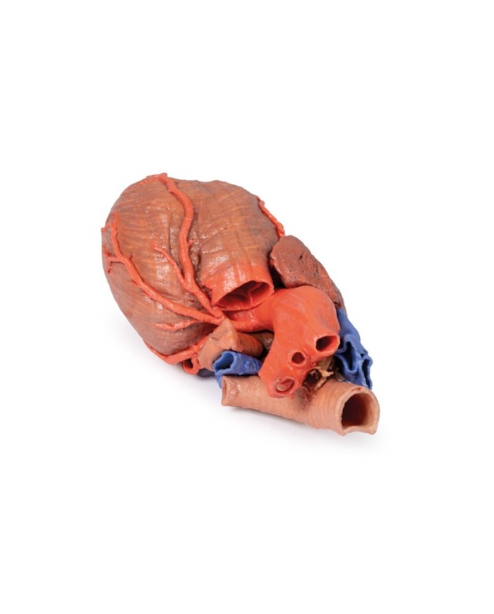 Cuore e trachea distale carena e bronchi primari Erler Zimmer 3D anatomy