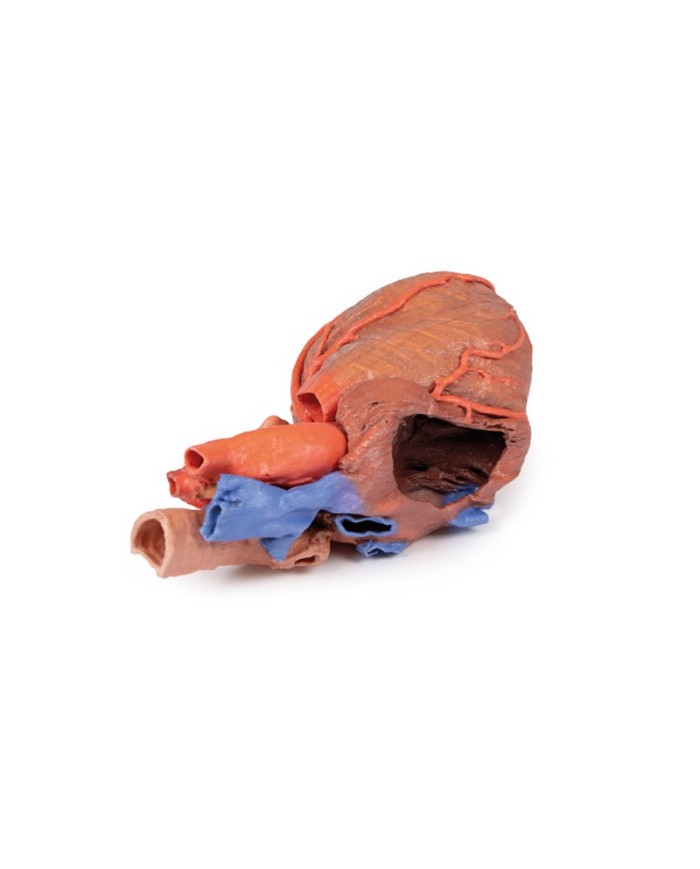 Cuore e trachea distale carena e bronchi primari Erler Zimmer 3D anatomy