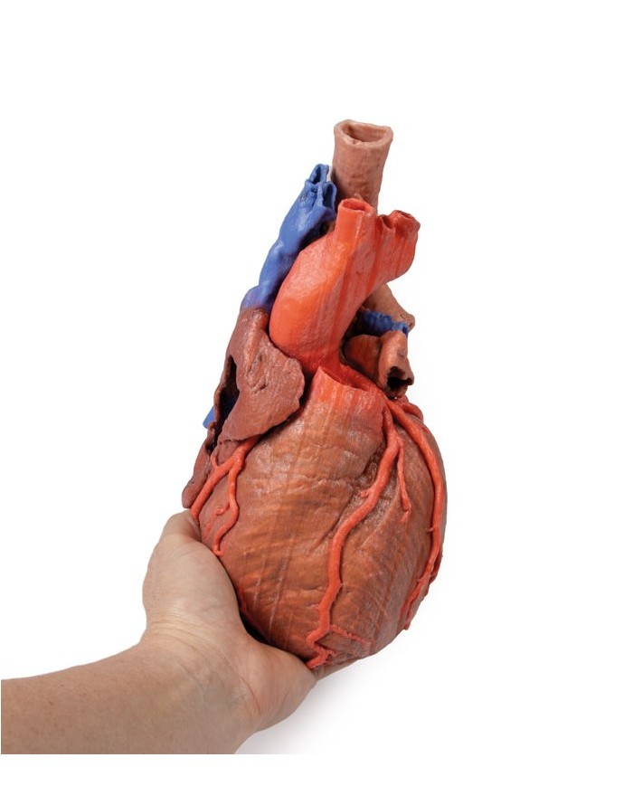 Cuore e trachea distale carena e bronchi primari Erler Zimmer 3D anatomy