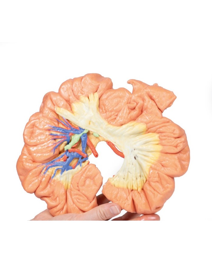 Intestino porzione di ilo Erler Zimmer 3D anatomy Series