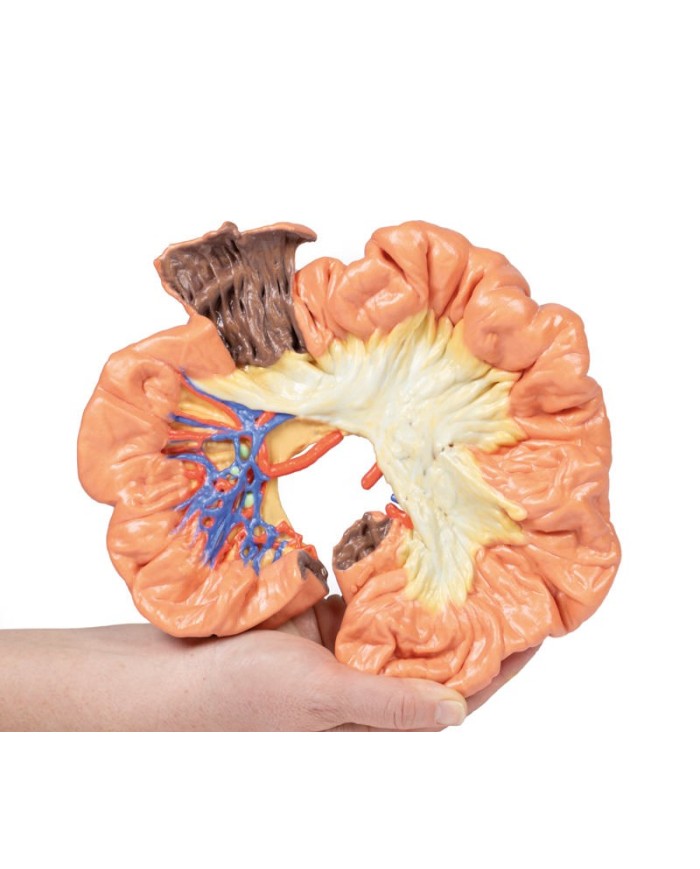 Intestino porzione di ilo Erler Zimmer 3D anatomy Series