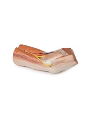 Fossa cubitale muscoli nervi principali e arteria brachiale Erler Zimme