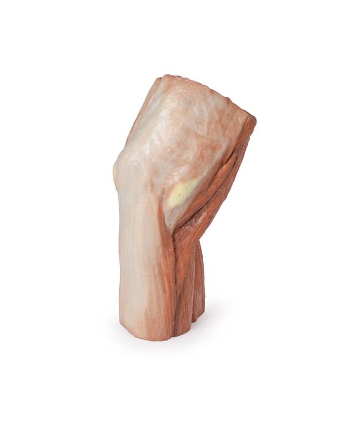 Fossa cubitale muscoli nervi principali e arteria brachiale Erler Zimme