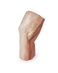 Fossa cubitale muscoli nervi principali e arteria brachiale Erler Zimme