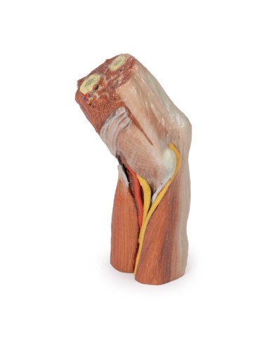 Fossa cubitale muscoli nervi principali e arteria brachiale Erler Zimme Fossa cubitale muscoli nervi principali e arteria brachiale Erler Zimme