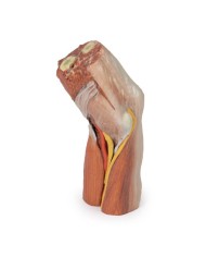 Fossa cubitale muscoli nervi principali e arteria brachiale Erler Zimme