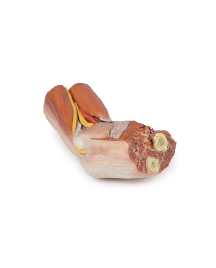 Fossa cubitale muscoli nervi principali e arteria brachiale Erler Zimme