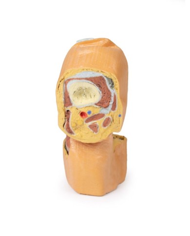 Dissezione profonda dell'articolazione del ginocchio flessa- Erler Zimmer 3D anatomy Series