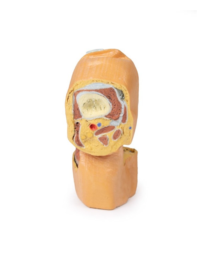 Dissezione profonda dell'articolazione del ginocchio flessa- Erler Zimmer 3D anatomy Series