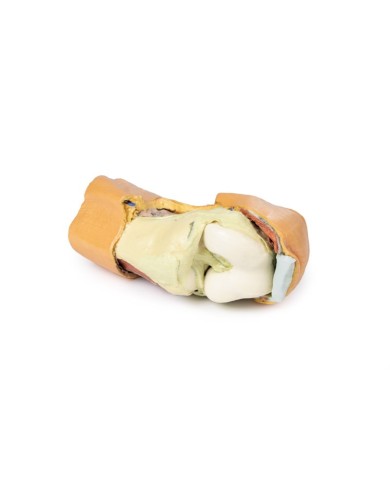 Dissezione profonda dell'articolazione del ginocchio flessa- Erler Zimmer 3D anatomy Series