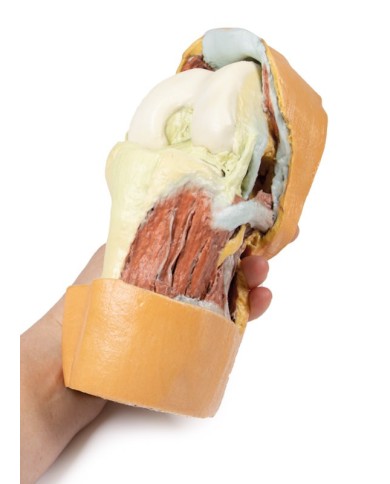 Dissezione profonda dell'articolazione del ginocchio flessa- Erler Zimmer 3D anatomy Series