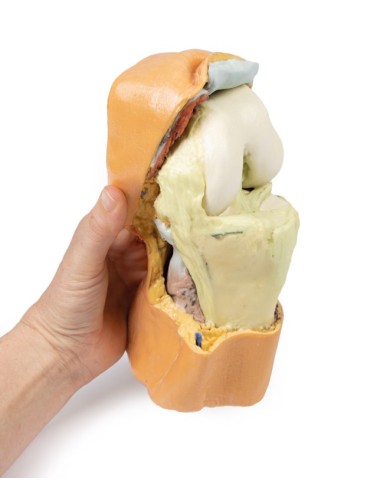 Dissezione profonda dell'articolazione del ginocchio flessa- Erler Zimmer 3D anatomy Series