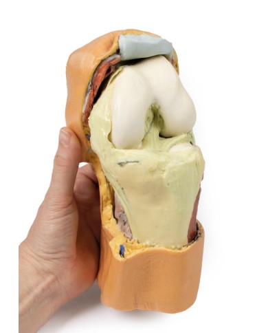 Dissezione profonda dell'articolazione del ginocchio flessa- Erler Zimmer 3D anatomy Series