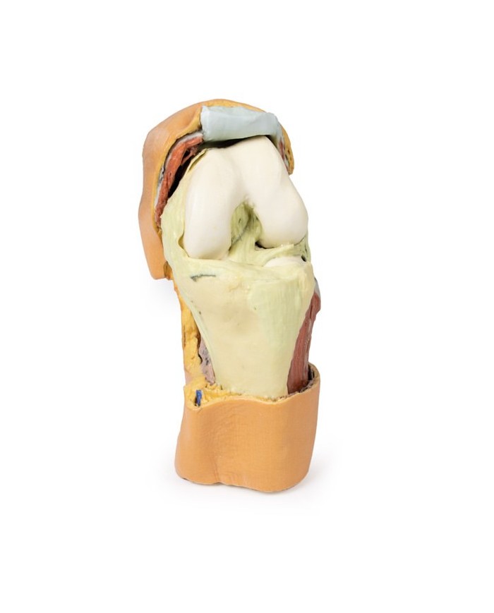 Dissezione profonda dell'articolazione del ginocchio flessa- Erler Zimmer 3D anatomy Series