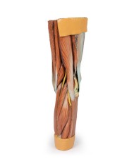 Dissezione della muscolatura dell arto inferiore Erler Zimmer 3D anatomy Dissezione della muscolatura dell arto inferiore Erler Zimmer 3D anatomy