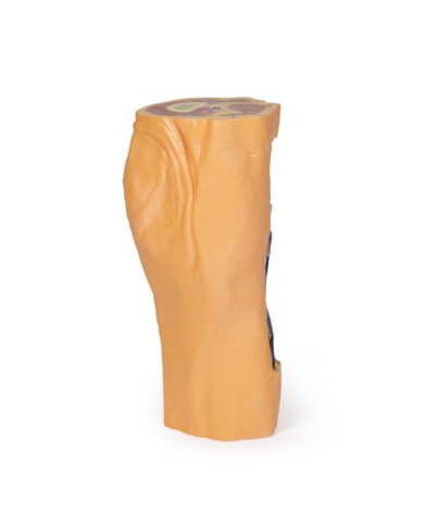 Fossa Poplitea con distale della coscia e gambra prossimale - Erler Zimmer 3D anatomy Series