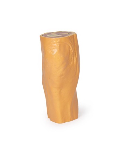 Fossa Poplitea con distale della coscia e gambra prossimale - Erler Zimmer 3D anatomy Series