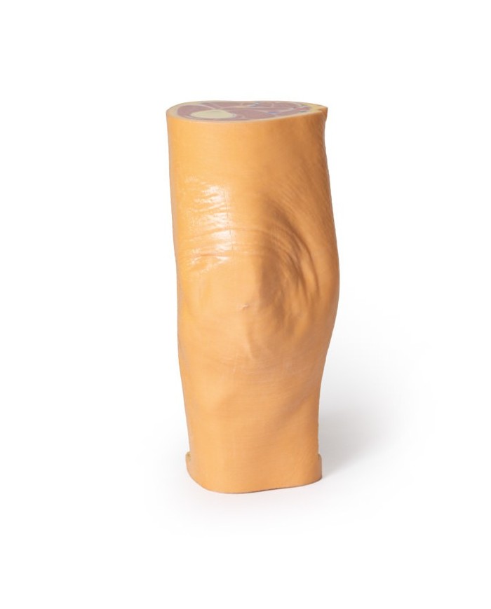 Dissezione profonda della Fossa Poplitea - Erler Zimmer 3D anatomy Series