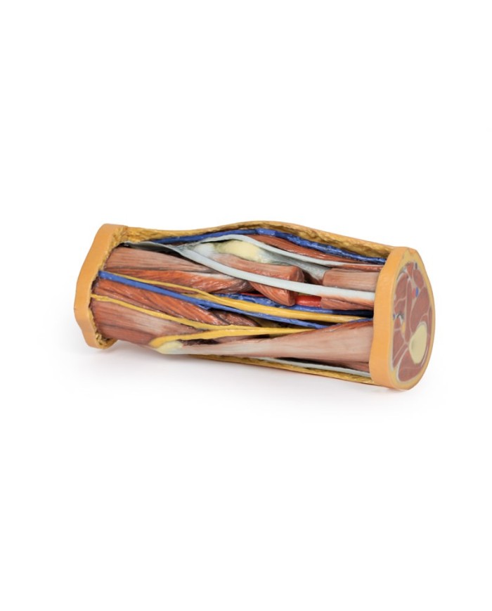 Dissezione profonda della Fossa Poplitea - Erler Zimmer 3D anatomy Series