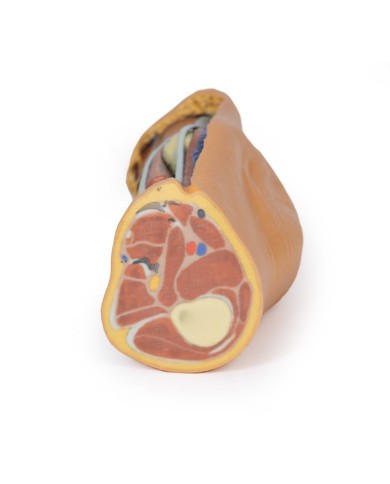 Dissezione profonda della Fossa Poplitea - Erler Zimmer 3D anatomy Series